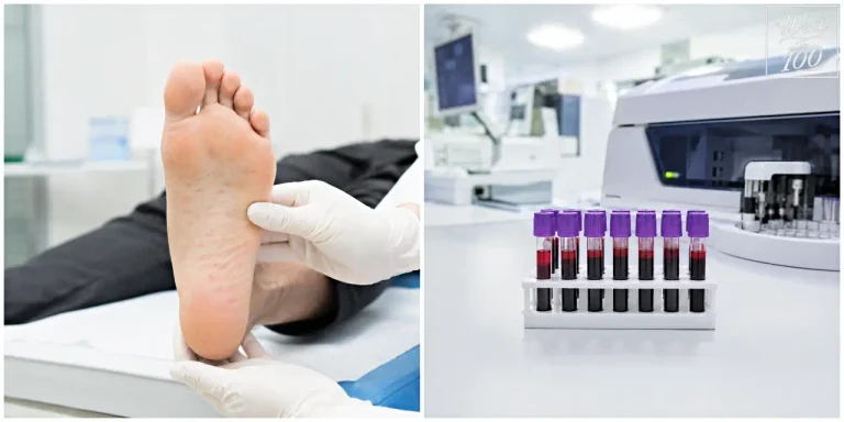 Foot rash examination and blood samples in a laboratory (발바닥 피부발진 진찰과 검사실 혈액 검체)